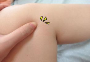 小腿水腫是什么原因引起的？教你輕松解決之道