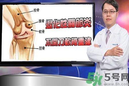 膝蓋痛怎么辦？膝蓋痛如何治療好？