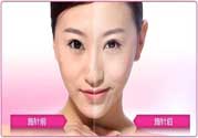美白針真的有效嗎？美白針的危害有哪些？