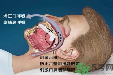 耳鳴是什么原因引起的？耳鳴怎么治療最好？