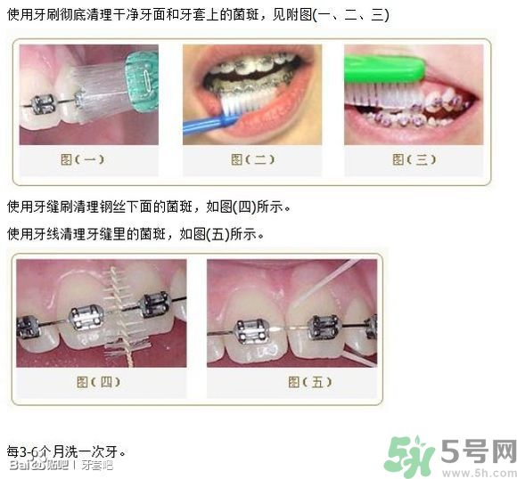 18歲還能戴牙套嗎？戴牙套真的能瘦臉改變臉型嗎？