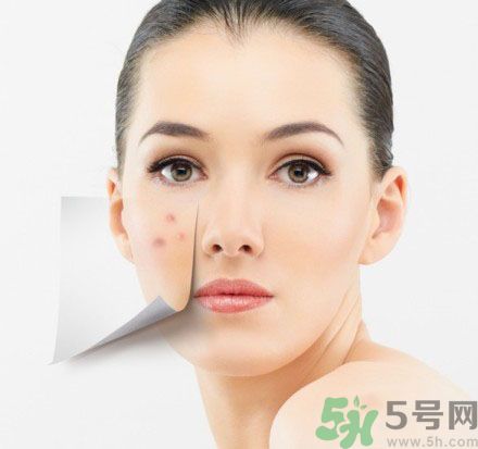 臉上有斑怎么去除？祛斑的小偏方有哪些？