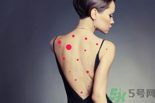 背上為什么會(huì)長(zhǎng)痘痘？長(zhǎng)痘痘怎么辦？