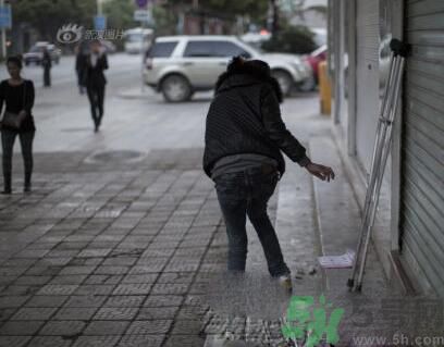 學(xué)生患東方美女病是怎么回事？東方美女病是什么?。? width=