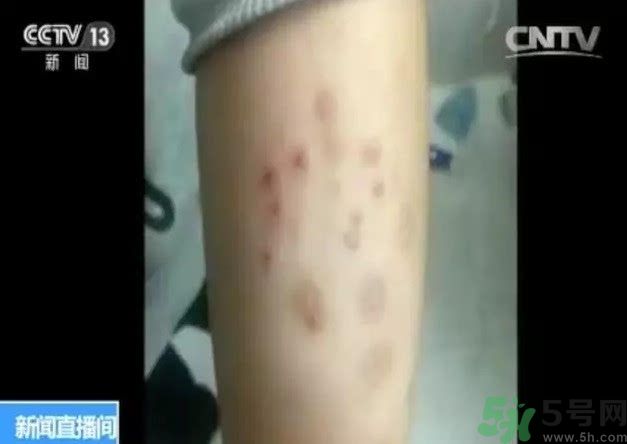 被污染學校是哪個？500師生患病的原因？
