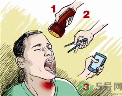 魚刺卡喉喝醋可以治療嗎？魚刺卡喉喝醋好不好？