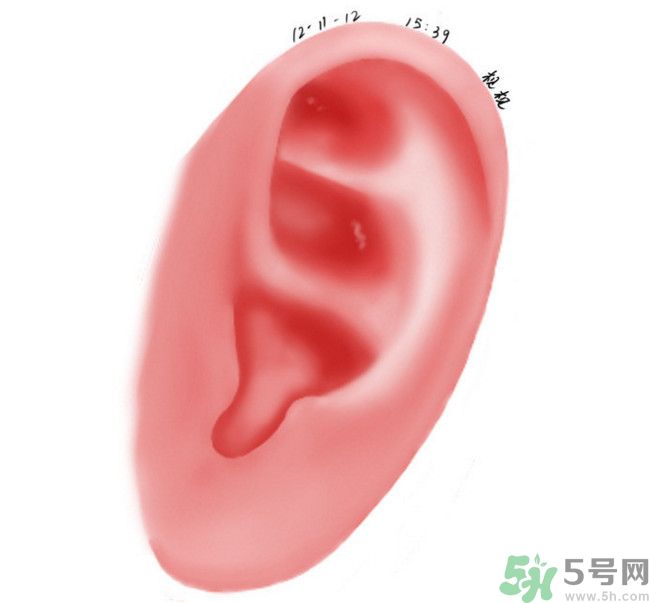 耳石脫落導(dǎo)致的眩暈怎么辦？耳石癥暈眩能自愈嗎？