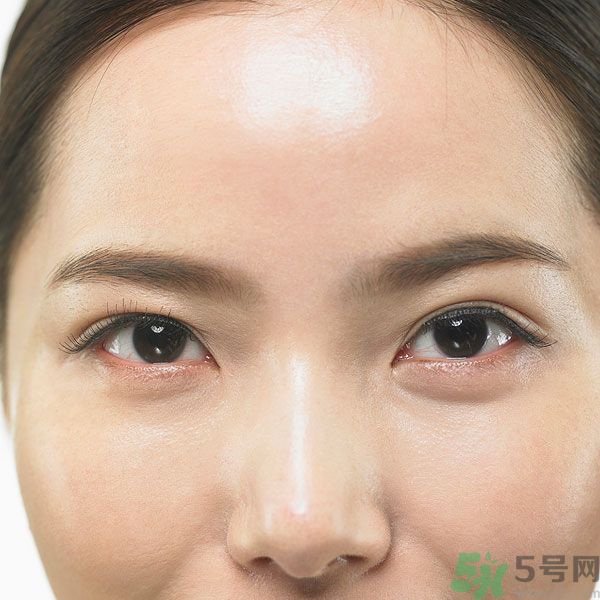 眉周紋是怎么形成的？眉周紋怎么去除？