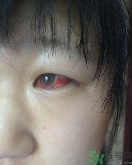 初中生全體甲醛中毒是怎么回事？初中生全體甲醛中毒是哪個學(xué)校？