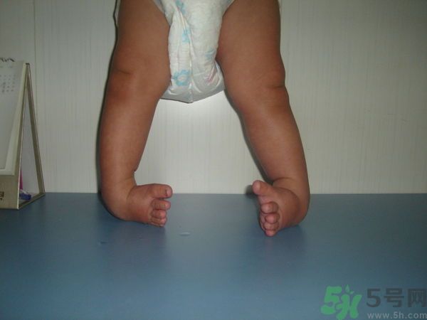 女生3天花8萬是怎么回事？馬蹄足是什么?。? width=