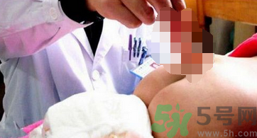 幼童屁股長(zhǎng)出尾巴的原因是什么？孕婦缺什么幼童屁股長(zhǎng)出尾巴？
