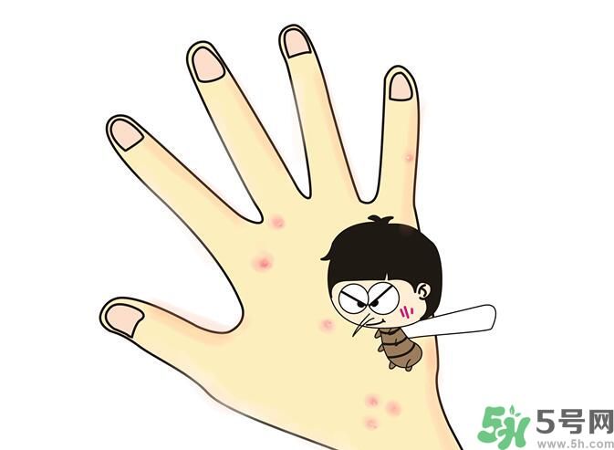 蚊子叮的包過幾天又癢是為什么？蚊子叮的包過幾天又癢怎么辦？