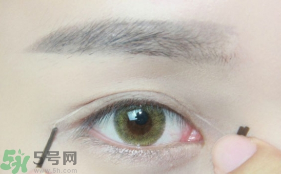 單眼皮怎么變雙眼皮了？單眼皮上面有一條線