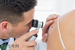 臉上長(zhǎng)痣是什么原因？臉上為什么會(huì)長(zhǎng)痣？