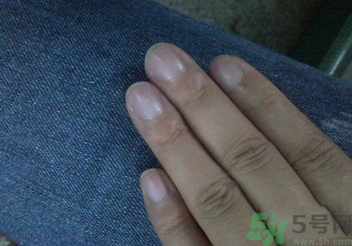 指甲發(fā)紫是什么原因？指甲發(fā)紫是怎么回事？
