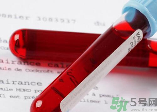 獻(xiàn)血后可以洗澡嗎？抽血后可以洗澡嗎？