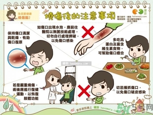 手被油燙傷了怎么處理？手被油燙起泡了怎么辦？