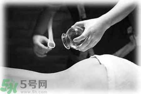大暑可以拔罐嗎？大暑拔罐好不好？