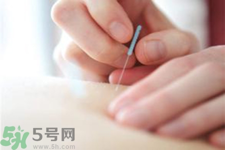 大暑可以針灸嗎？大暑針灸好不好？
