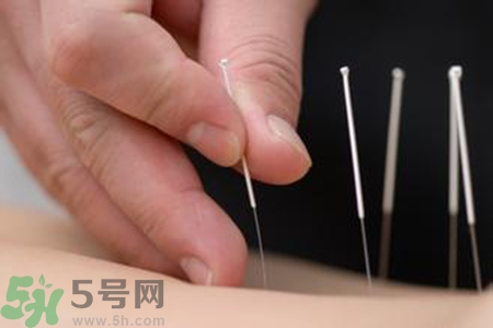 大暑可以針灸嗎？大暑針灸好不好？