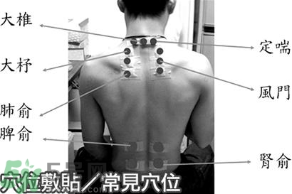 經(jīng)期可以貼三伏貼嗎？來月經(jīng)可以貼三伏貼嗎？