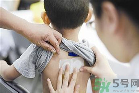 肝炎貼三伏貼有用嗎？肝病貼三伏貼貼哪里？