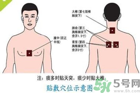 肝炎貼三伏貼有用嗎？肝病貼三伏貼貼哪里？
