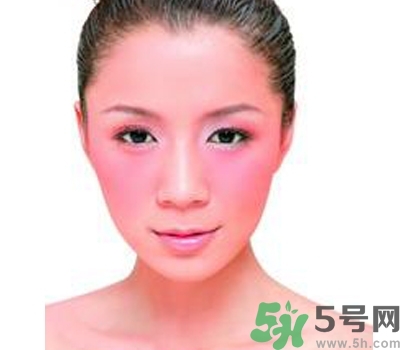 敏感性皮膚用什么洗面奶？敏感性皮膚怎么修復(fù)？