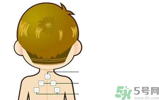 三伏貼可以去濕氣嗎？三伏貼去濕氣貼哪里？