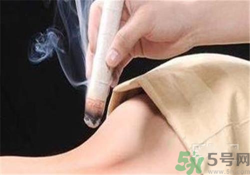 蕁麻疹可以艾灸嗎？蕁麻疹艾灸哪個穴位？