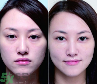 臥蠶是什么？臥蠶是眼袋嗎？