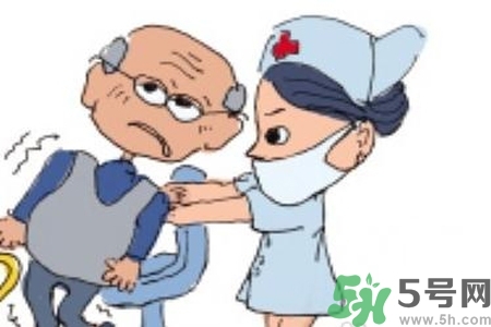 癲癇的典型癥狀有哪些？癲癇是什么？