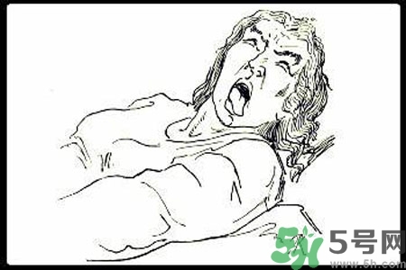 癲癇的護理措施？癲癇的飲食護理是什么？