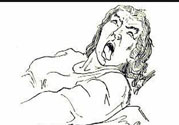 癲癇的發(fā)病因素？癲癇的并發(fā)癥有哪些？