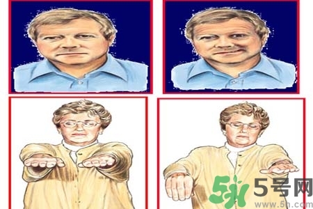 腦中風(fēng)是什么？腦中風(fēng)的癥狀？
