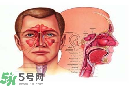 鼻竇炎的高發(fā)人群？如何預(yù)防鼻竇炎？