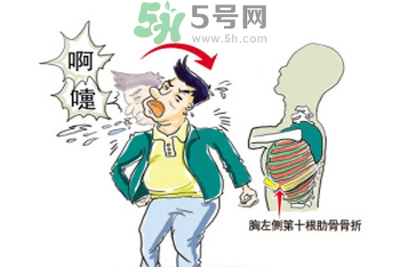 過敏性鼻炎是什么？過敏性鼻炎的癥狀有哪些？