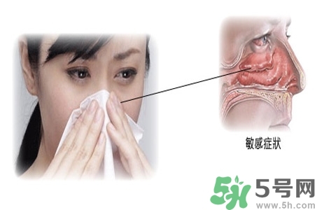 過敏性鼻炎的高發(fā)人群有哪些？如何預(yù)防過敏性鼻炎？