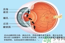 青光眼是什么？青光眼癥狀有什么？