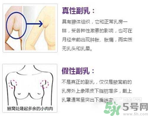 副乳是什么？副乳的危害