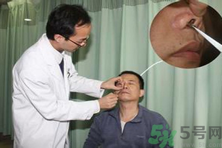 鼻咽癌的治療方法是什么？鼻咽癌可以用什么藥物治療？