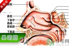 鼻咽癌的發(fā)病因素是什么？鼻咽癌的并發(fā)癥有哪些？