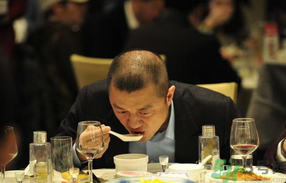 男人禿頂會(huì)遺傳嗎？男人禿頂是腎虛嗎？