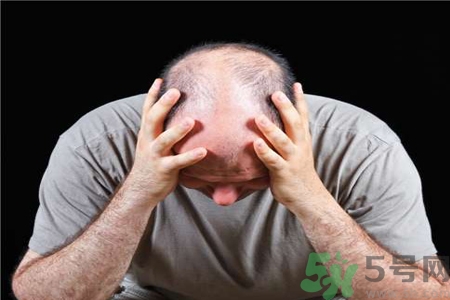 脫發(fā)的高發(fā)人群有哪些？如何預(yù)防脫發(fā)？