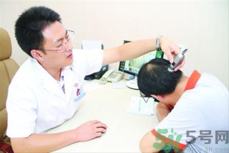 脫發(fā)會遺傳嗎？脫發(fā)遺傳可以治療嗎？