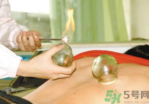拔火罐和拔氣罐哪個(gè)好？拔火罐和拔氣罐的區(qū)別