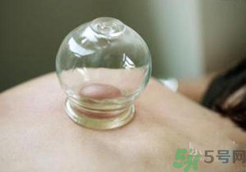 拔火罐和拔氣罐哪個(gè)好？拔火罐和拔氣罐的區(qū)別