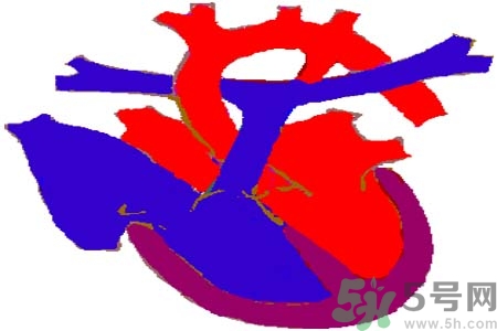 先天性心臟病發(fā)病原因是什么？