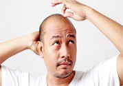 脫發(fā)的高發(fā)人群有哪些？如何預(yù)防脫發(fā)？