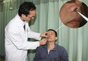 鼻咽癌的發(fā)病因素是什么？鼻咽癌的并發(fā)癥有哪些？